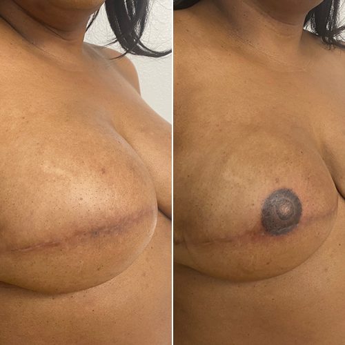 3D Nipple Tattoo on Right