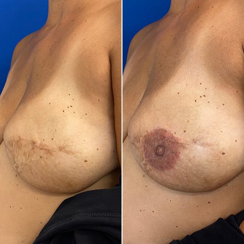 3D Nipple Tattoo on Left